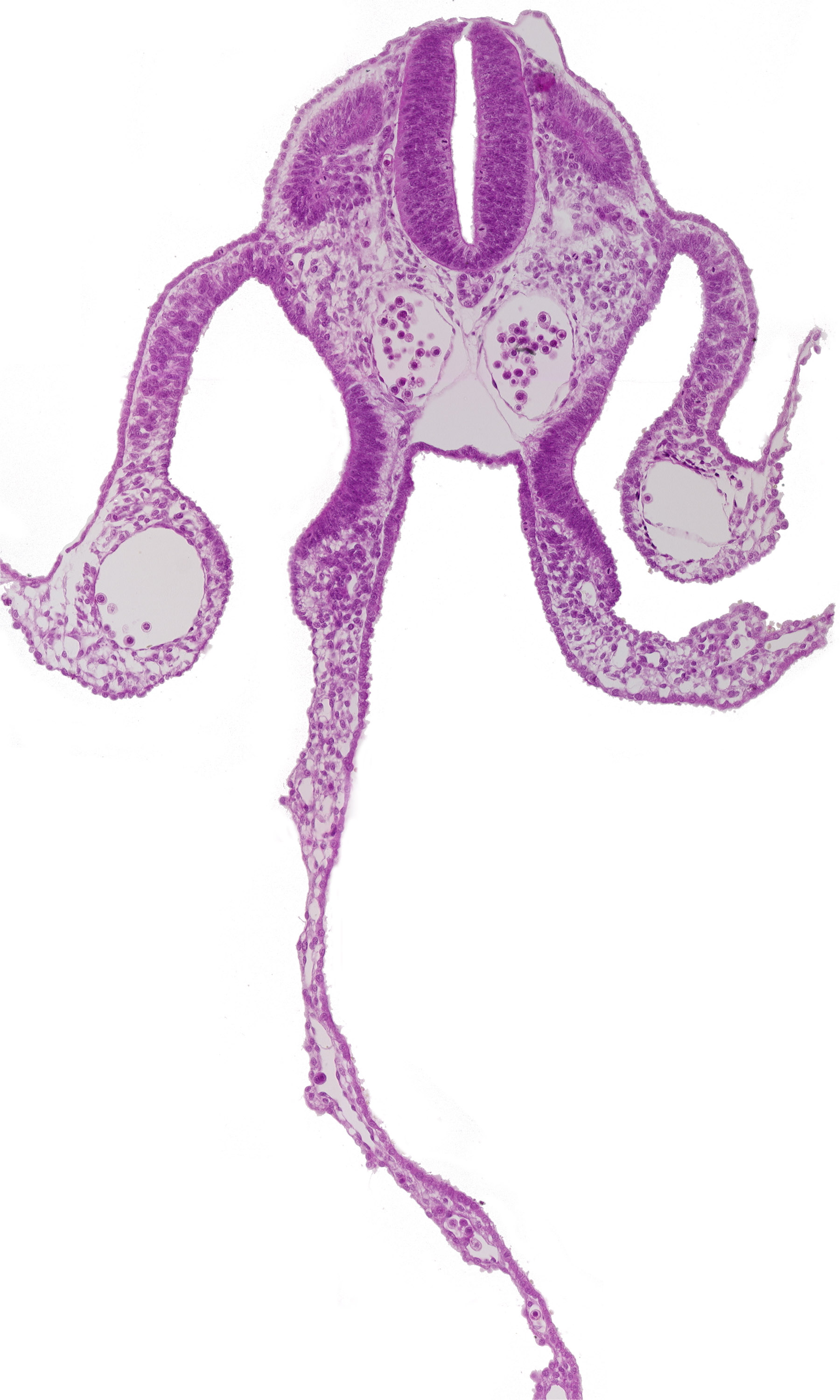 dermatomyotome 8 (C-4), dorsal aorta, left umbilical vein, mesothelium of peritoneal cavity, mesothelium of umbilical vesicle, notochord, right umbilical vein, umbilical venous plexus in umbilical vesicle wall