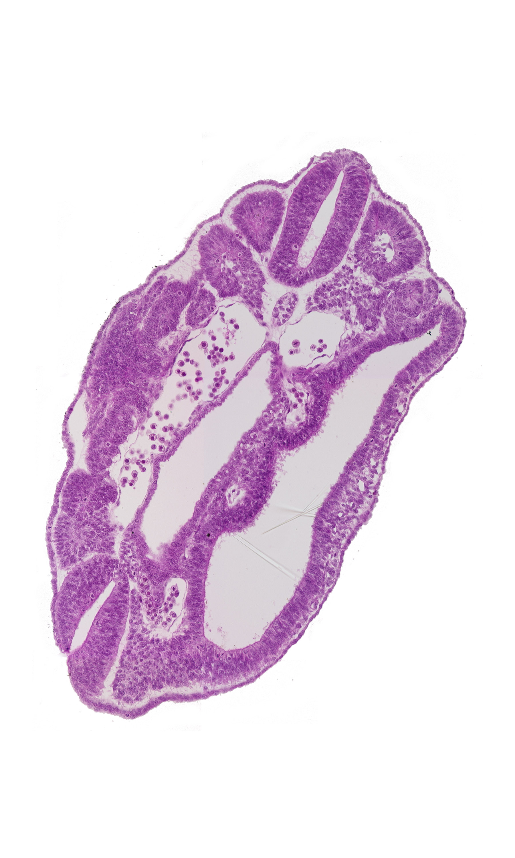 dermatomyotome 16 (T-4), fusing neural folds, hindgut, junction of aorta and right common iliac artery, left common iliac artery, neural tube, notochord, perinotochordal lamina, peritoneal cavity, somatopleure, splanchnopleure, ventral edge of somite 17 (T-5)