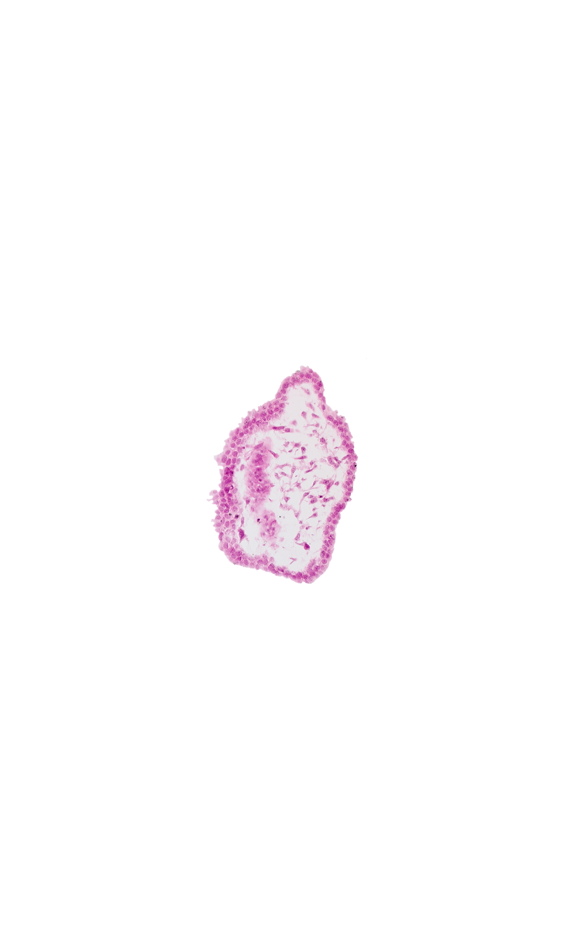 cephalic edge of mesencephalon (M2), cephalic edge of rhombencephalon (Rh. 1), head mesenchyme