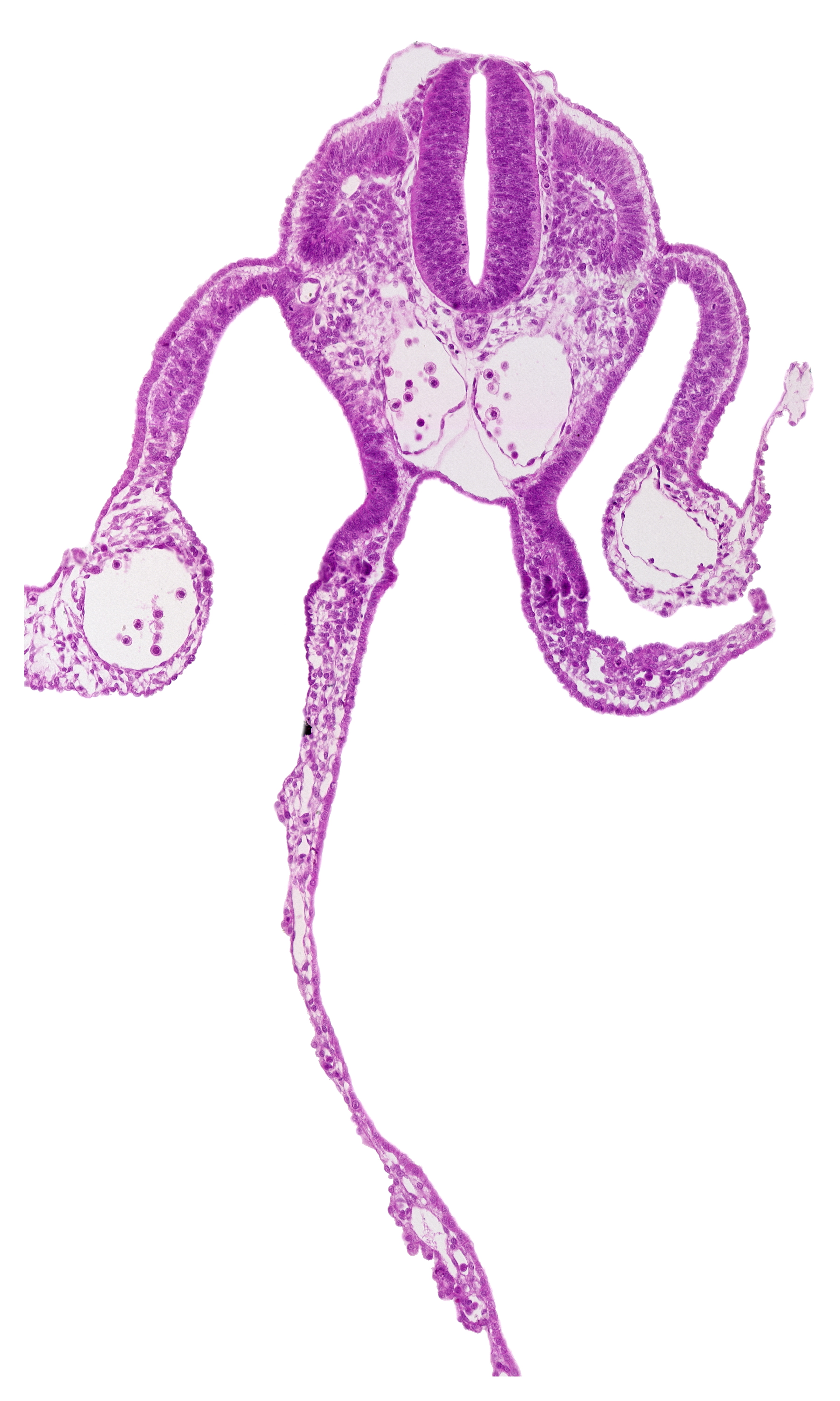 artifact space(s), communication between peritoneal cavity and extra-embryonic coelom, dermatomyotome 9 (C-5), dorsal aorta, midgut, notochord, presumptive upper limb bud, primordial omental bursa, right umbilical vein, umbilical vesicle wall