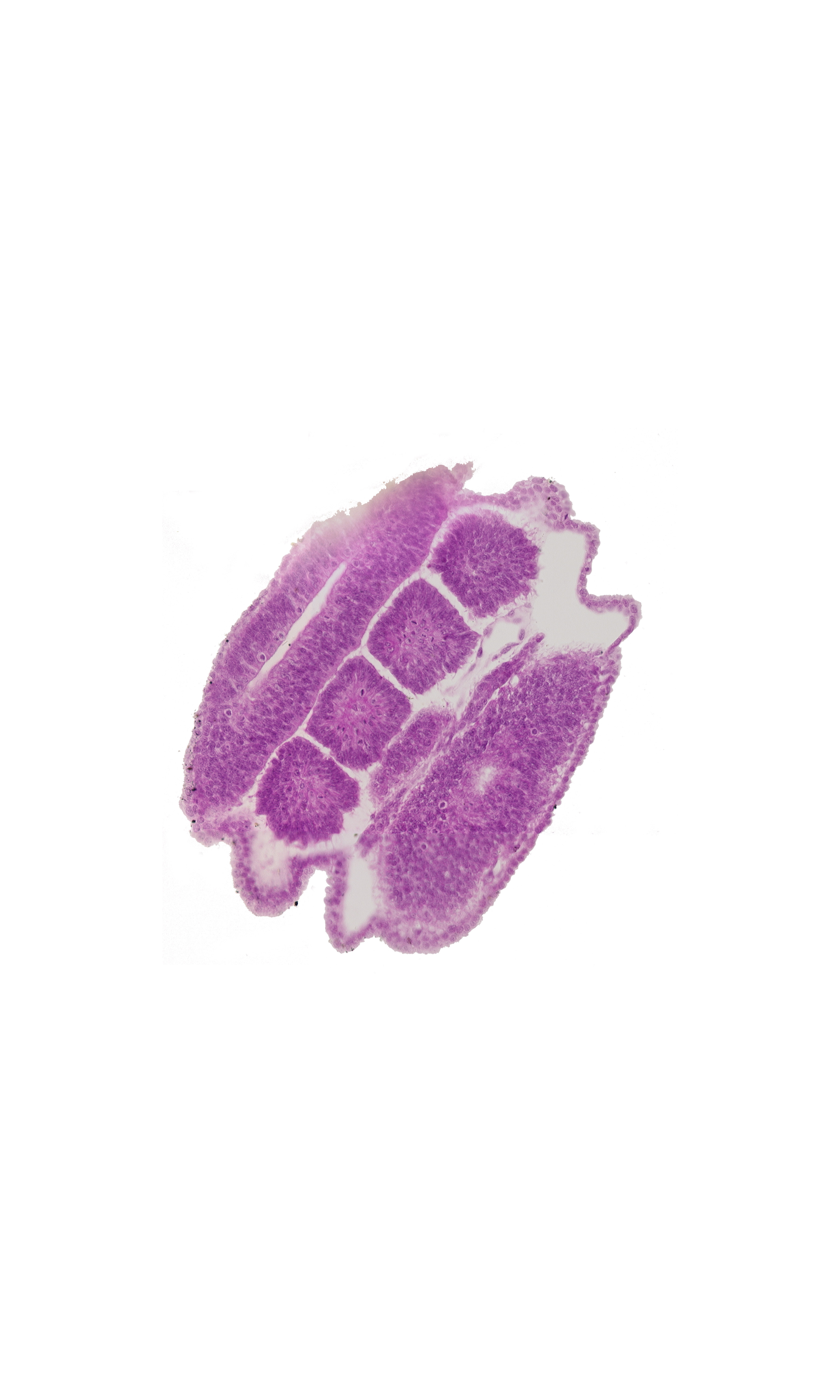edge of intermediate mesenchyme, somatopleuric mesoderm, somite 19 (T-7), somite 20 (T-8), somite 21 (T-9), somite 22 (T-10), surface ectoderm