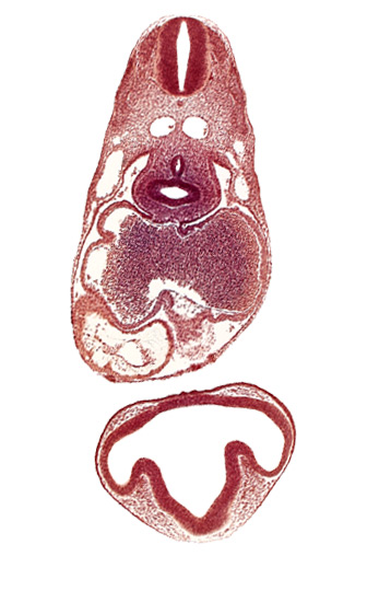 C-2 spinal ganglion primordium, caudal edge of tracheo-esophageal septum, common cardinal vein, conus cordis: endocardium, conus cordis: epimyocardium, conus cordis: gelatinous reticulum, dermatomyotome 6 (C-2), intraretinal space (optic vesicle cavity), left atrium, left lung bud, lens disc, mesocardium, notochord, optic evagination, optic part of retina, optic stalk (CN II), ostium primum, pericardioperitoneal canal (pleural cavity), postcardinal vein, primary interatrial septum (septum primum), prosencoel (third ventricle), sclerotome, sinu-atrial foramen, trachea primordium, ventral thalamus (diencephalon)