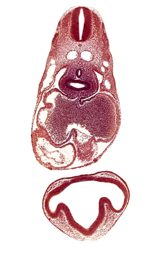 common cardinal vein, conus cordis: endocardium, conus cordis: epimyocardium, conus cordis: gelatinous reticulum, dermatomyotome 6 (C-2), dermatomyotome 7 (C-3), intraretinal space (optic vesicle cavity), left aorta, left atrium, left lung bud, lens disc, mesocardium, notochord, optic evagination, optic part of retina, pericardial cavity, pericardioperitoneal canal (pleural cavity), postcardinal vein, prosencoel (third ventricle), right atrium, right lung bud, sclerotome, sinu-atrial foramen, sinus venosus, trachea primordium, ventral thalamus (diencephalon)