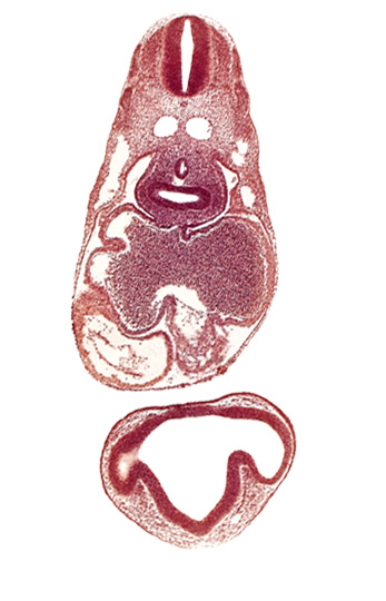 common cardinal vein, conus cordis: endocardium, conus cordis: epimyocardium, conus cordis: gelatinous reticulum, dermatomyotome 6 (C-2), dermatomyotome 7 (C-3), intraretinal space (optic vesicle cavity), left atrium, notochord, optic part of retina, pericardial cavity, pericardioperitoneal canal (pleural cavity), postcardinal vein, prosencoel (third ventricle), right atrium, right lung bud, sinus venosus, trachea primordium, ventral thalamus (diencephalon)