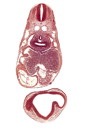 caudal edge of optic vesicle, common atrioventricular canal, common cardinal vein, dermatomyotome 6 (C-2), dermatomyotome 7 (C-3), esophagus primordium, left atrium, notochord, optic part of retina, pericardial cavity, pericardioperitoneal canal (pleural cavity), postcardinal vein, primary interatrial septum (septum primum), prosencoel (third ventricle), right atrium, right lung bud, sinus venosus, ventral thalamus (diencephalon)