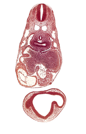 caudal edge of optic vesicle, common atrioventricular canal, common cardinal vein, dermatomyotome 7 (C-3), epimyocardium, esophagus primordium, gelatinous reticulum, intraretinal space (optic vesicle cavity), left atrium, notochord, optic part of retina, pericardial cavity, pericardioperitoneal canal (pleural cavity), postcardinal vein, primary interatrial septum (septum primum), prosencoel (third ventricle), right atrium, right lung bud, sinus venosus, ventral thalamus (diencephalon)