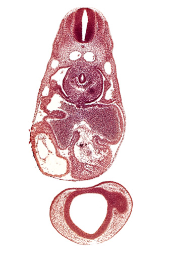 caudal edge of left lung bud, caudal edge of optic vesicle, common atrioventricular canal, common cardinal vein, dermatomyotome 7 (C-3), endocardium, epimyocardium, esophagus primordium, left atrium, notochord, postcardinal vein, prosencoel (third ventricle), sinu-atrial foramen, sinus venosus