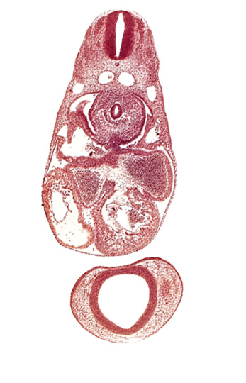 C-3 spinal ganglion primordium, anterior cerebral plexus, common atrioventricular canal (isthmus), common cardinal vein, dermatomyotome 7 (C-3), dorsal aorta, endocardium, epimyocardium, esophagus primordium, interventricular sulcus, left atrium, notochord, postcardinal vein, prosencephalon (telencephalic part), prosencoel (third ventricle), trabecular part of left ventricle