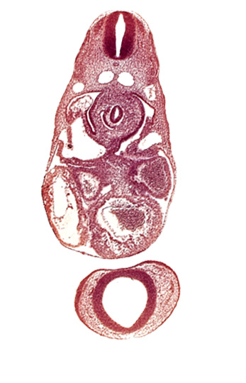 C-3 spinal ganglion primordium, anterior cerebral plexus, common cardinal vein, dermatomyotome 7 (C-3), dorsal aorta, endocardium, epimyocardium, interventricular sulcus, left atrium, notochord, postcardinal vein, prosencephalon (telencephalic part), prosencoel (third ventricle), trabecular part of left ventricle