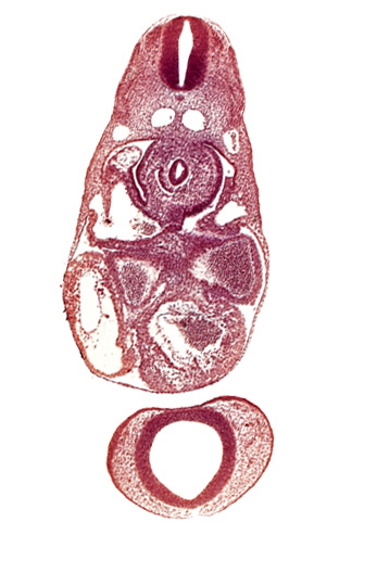 C-3 spinal ganglion primordium, common cardinal vein, dermatomyotome 7 (C-3), dorsal aorta, endocardium, epimyocardium, interventricular sulcus, left atrium, notochord, postcardinal vein, prosencephalon (telencephalic part), prosencoel (third ventricle), right atrium, sinus venosus, trabecular part of left ventricle