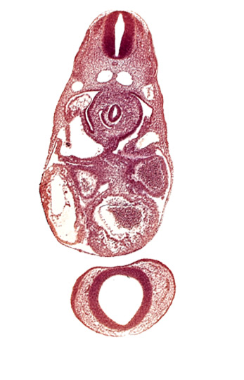 C-3 spinal ganglion primordium, dermatomyotome 7 (C-3), dorsal aorta, endocardium, left atrium, left common cardinal vein, notochord, postcardinal vein, prosencephalon (telencephalic part), prosencoel (third ventricle), right atrium, sinus venosus, trabecular part of left ventricle