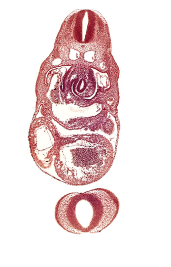C-3 spinal ganglion primordium, endocardium, junction of left common cardinal vein and sinus venosus, left ventricle, nasal disc (olfactory placode), notochord, pericardial cavity, postcardinal vein, prosencephalon (telencephalic part), prosencoel (third ventricle), sinus venosus, stomach primordium