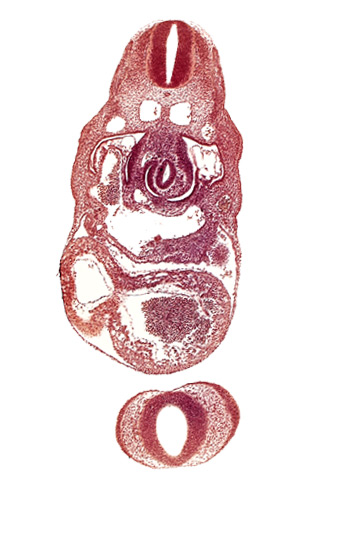 C-3 spinal ganglion primordium, caudal edge of left atrium, dermatomyotome 8 (C-4), dorsal aorta, left ventricle, nasal disc (olfactory placode), notochord, pericardial cavity, postcardinal vein, prosencephalon (telencephalic part), prosencoel (third ventricle), sinus venosus, stomach primordium