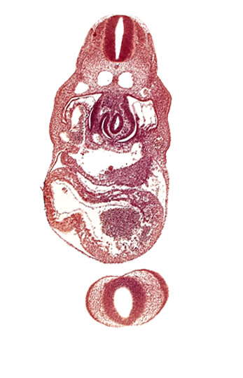 C-4 spinal ganglion primordium, anterior interventricular sulcus, cephalic edge of upper limb bud, dermatomyotome 8 (C-4), dorsal aorta, endocardium, epimyocardium, interventricular foramen, junction of hepatocardiac and umbilical veins, left horn of sinus venosus, left umbilical vein, nasal disc (olfactory placode), notochord, postcardinal vein, posterior interventricular sulcus, prosencoel (third ventricle), stomach primordium, telencephalon medium