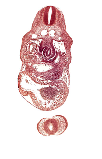 anterior interventricular sulcus, cephalic edge of hepatic lamina, dermatomyotome 8 (C-4), dorsal aorta, epimyocardium, nasal disc (olfactory placode), notochord, pericardial cavity, postcardinal vein, prosencoel (third ventricle), right umbilical vein, sinus venosus, stomach primordium, telencephalon medium, trabecular part of left ventricle, upper limb bud