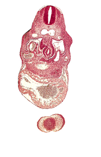 anterior interventricular sulcus, dermatomyotome 8 (C-4), hepatic lamina(e), hepatocardiac vein, interventricular foramen, junction of left and right dorsal aortas, lamina terminalis of prosencephalon, nasal disc (olfactory placode), notochord, pericardial cavity, right umbilical vein, trabecular part of left ventricle, upper limb bud