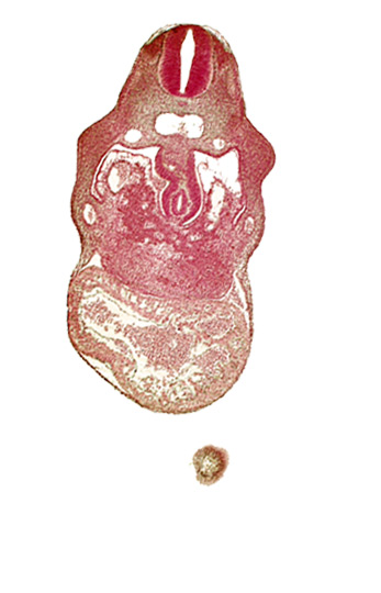 anterior interventricular sulcus, edge of head, hepatic lamina(e), hepatic sinusoid, hepatocardiac vein, left umbilical vein, notochord, right umbilical vein, united dorsal aortas, upper limb bud