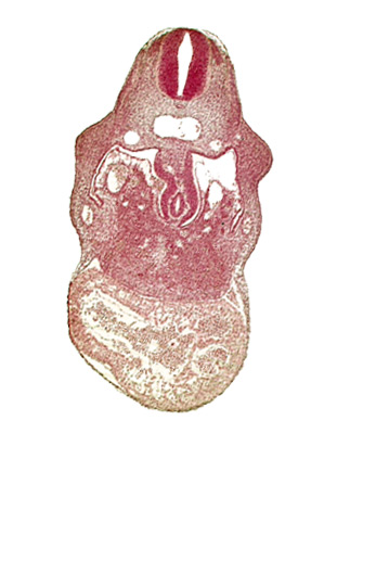 C-4 spinal ganglion primordium, anterior interventricular sulcus, coelomic cavity, dorsal mesogastrium, endocardium, hepatic sinusoid, hepatocardiac vein, left umbilical vein, notochord, postcardinal vein, primary interventricular foramen, right umbilical vein (involuting), stomach primordium, united dorsal aortas, upper limb bud, ventral mesogastrium