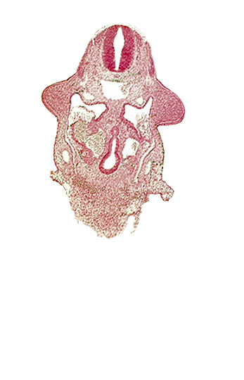 amnion attachment, aorta, caudal edge of common ventricle, dermatomyotome 9 (C-5), dorsal pancreatic bud, hepatic antrum, left hepatocardiac vein, notochord, postcardinal vein, right hepatocardiac vein, specialized coelomic wall, upper limb bud