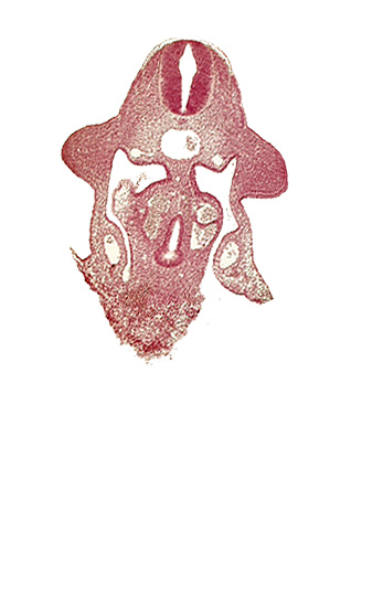 amnion attachment, aorta, apical ectodermal ridge, coelomic cavity, duodenum primordium, neural tube, postcardinal vein, sulcus limitans, upper limb bud