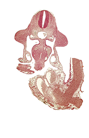 C-6 spinal ganglion primordium, allantois, aorta, apical ectodermal ridge, coelomic cavity, common umbilical vein, communication between coelomic cavity and extra-embryonic coelom, dermatomyotome 10 (C-6), dorsal mesentery, left umbilical artery, left vitelline (omphalomesenteric) vein, midgut, neural canal, postcardinal vein, right umbilical artery, umbilical vesicle stalk, upper limb bud