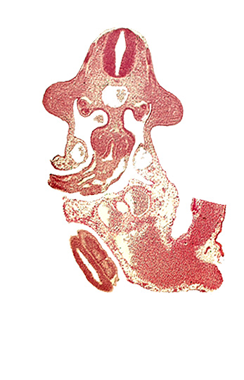 allantois, aorta, coelomic cavity, common umbilical vein, dermatomyotome 10 (C-6), edge of caudal eminence, gonadal epithelium, left umbilical artery, left umbilical vein, mesentery proper, neural canal, omphaloenteric duct, postcardinal vein, right umbilical vein, somite 31 (S-2), somite 32 (S-3), upper limb bud