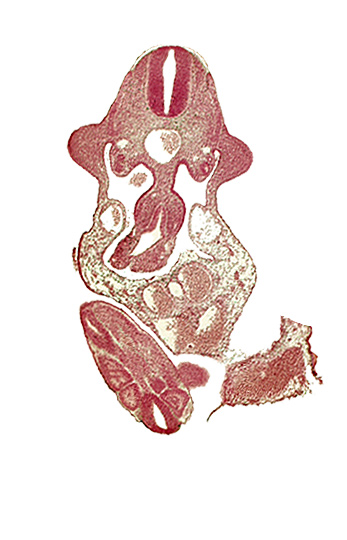 alar plate(s), allantois, aorta, basal plate, caudal plexus of veins, coelomic cavity, dermatomyotome 11 (C-7), junction of midgut and omphalo-enteric duct, neural canal, paraxial mesoderm, somite 30 (S-1), somite 31 (S-2), somite 32 (S-3), sulcus limitans, upper limb bud