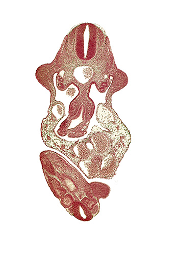 C-7 spinal ganglion primordium, aorta, caudal edge of cloaca, caudal eminence, caudal end of neural tube, coelomic cavity, dermatomyotome 11 (C-7), floor plate, junction of midgut and omphalo-enteric duct, left umbilical artery, left umbilical vein, lower limb bud, mesonephric duct, mesonephros, roof plate, somite 30 (S-1), somite 31 (S-2), sulcus limitans, upper limb bud