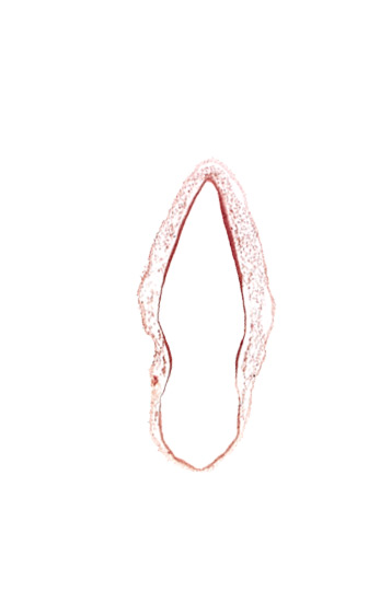 alar plate(s), head mesenchyme, rhombencoel (fourth ventricle), roof plate of rhombencephalon, surface ectoderm