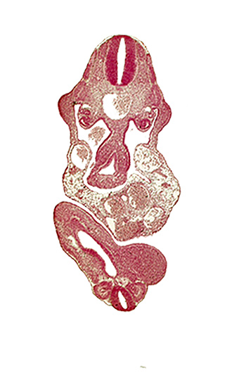 C-7 spinal ganglion primordium, abdominal wall, allantois, aorta, caudal eminence, cloaca, dermatomyotome 11 (C-7), dermatomyotome 12 (C-8), junction of midgut and omphalo-enteric duct, lower limb bud, mesonephric duct, neural tube, postcardinal vein, right umbilical artery, somite 29 (L-5), somite 30 (S-1), upper limb bud