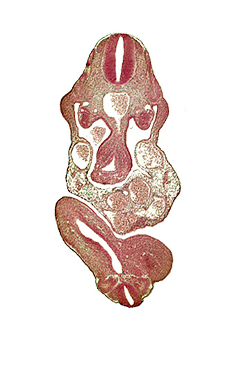 C-7 spinal ganglion primordium, allantois, aorta, cloaca, dermatomyotome 11 (C-7), dermatomyotome 12 (C-8), left umbilical artery, lower limb bud, mesonephric duct, midgut, neural canal, neural tube, postcardinal vein, primary intestinal plexus artery, right umbilical artery, right umbilical vein, somite 29 (L-5), somite 30 (S-1), subcardinal vein