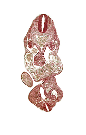 aorta, caudal eminence, cloaca, coelom, dermatomyotome 13 (T-1), left umbilical artery, left umbilical vein, lower limb bud, mesonephric duct, notochord, primary intestinal plexus artery, right umbilical vein, somite 28 (L-4)