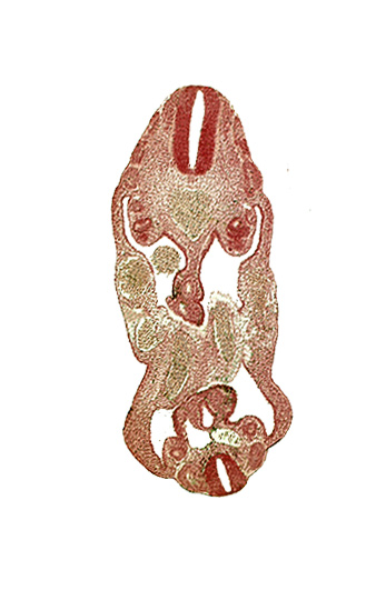 aorta, coelom, dermatomyotome 14 (T-2), dermatomyotome 26 (L-2), hindgut, left common iliac artery, left umbilical artery, mesonephric duct, neural canal, right common iliac artery, right umbilical artery, right umbilical vein