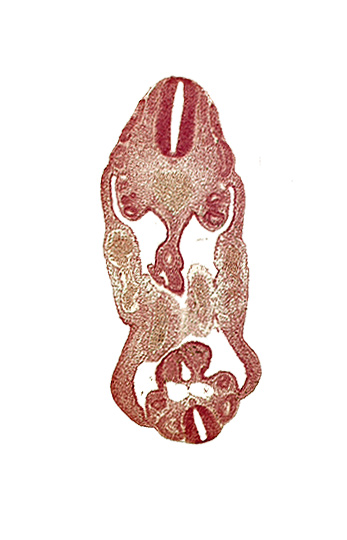 aorta, coelom, dermatomyotome 14 (T-2), dermatomyotome 26 (L-2), left common iliac artery, left umbilical artery, mesonephric duct, neural canal, right common iliac artery, right umbilical artery, right umbilical vein