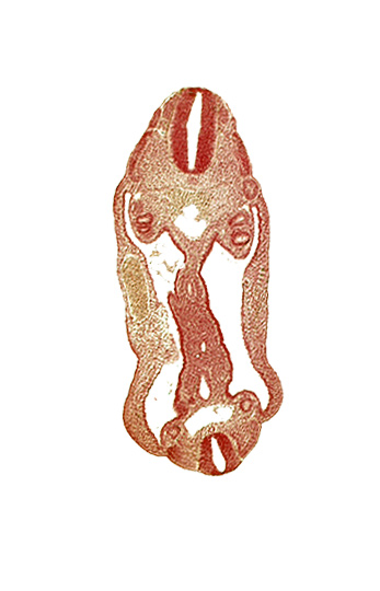 aorta, aortic bifurcation, coelom, dermatomyotome 15 (T-3), dermatomyotome 26 (L-2), hindgut, mesentery, neural tube, notochord