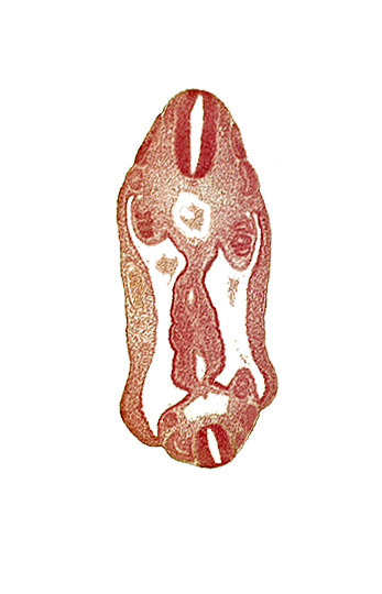 aorta, aortic bifurcation, coelom, dermatomyotome 15 (T-3), dermatomyotome 16 (T-4), dermatomyotome 25 (L-1), dermatomyotome 26 (L-2), hindgut, mesentery, neural tube, notochord