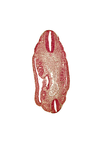 T-4 spinal ganglion primordium, aorta, dermatomyotome 16 (T-4), dermatomyotome 17 (T-5), dermatomyotome 18 (T-6), dermatomyotome 23 (T-11), dermatomyotome 24 (T-12), edge of coelom, mesonephric duct, mesonephric vesicle(s), mesonephros, neural tube, sclerotome