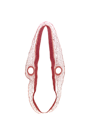 mantle layer, marginal layer, otic vesicle, otic vesicle cavity, posterior dural venous plexus, rhombencoel (fourth ventricle), rhombomere 6, roof plate, surface ectoderm