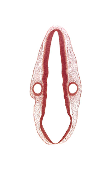 head mesenchyme, mantle layer, otic vesicle, posterior dural venous plexus, rhombencoel (fourth ventricle), roof plate, surface ectoderm