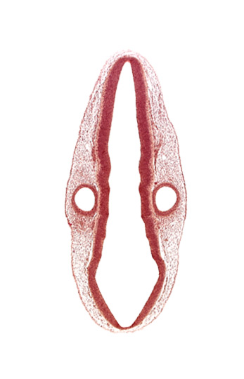 mantle layer, marginal layer, middle dural venous plexus, otic vesicle, rhombencephalon (hindbrain), rhombencoel (fourth ventricle), rhombomere 4, rhombomere 6, rhombomere 7, roof plate