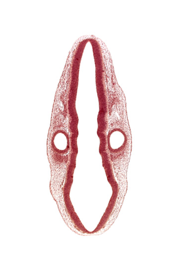 cephalic edge of dermatomyotome 1 (O-1), head mesenchyme, otic vesicle, posterior dural venous plexus, primordium of vagus and accessory nerves (CN X and CN XI), rhombomere 6, root of facial nerve (CN VII), root of glossopharyngeal nerve (CN IX), root of vestibulocochlear nerve (CN VIII), surface ectoderm