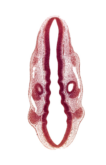 dermatomyotome 1 (O-1), dermatomyotome 2 (O-2) , marginal layer, otic vesicle, primary head vein, primordium of facial and vestibulocochlear nerves (CN VII and CN VIII), primordium of trigeminal nerve (CN V), primordium of vagus nerve (CN X), rhombencoel (fourth ventricle), rhombomere 2, rhombomere 4, rhombomere 7