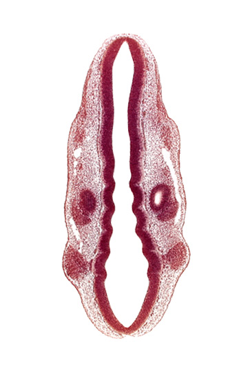 dermatomyotome 1 (O-1), dermatomyotome 2 (O-2) , marginal layer, primary head vein, primordium of facial and vestibulocochlear nerves (CN VII and CN VIII), primordium of trigeminal nerve (CN V), primordium of vagus nerve (CN X), rhombencoel (fourth ventricle), rhombomere 2, rhombomere 3, rhombomere 4, rhombomere 5, rhombomere 6, rhombomere 7