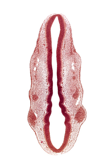 dermatomyotome 1 (O-1), dermatomyotome 2 (O-2) , pharyngeal arch 1, pharyngeal groove 1, primary head vein, primordium of facial nerve (CN VII), primordium of glossopharyngeal nerve (CN IX), primordium of trigeminal nerve (CN V), rhombomere 1, rhombomere 2, rhombomere 3, rhombomere 4, rhombomere 5, rhombomere 6