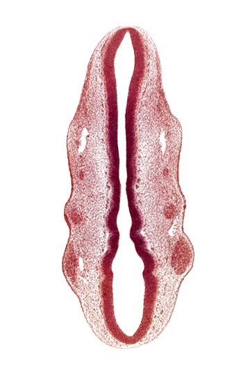 dermatomyotome 2 (O-2) , primary head vein, primordium of facial nerve (CN VII), primordium of glossopharyngeal nerve (CN IX), primordium of trigeminal nerve (CN V), rhombomere 2, rhombomere 3, rhombomere 4, rhombomere 5, rhombomere 6