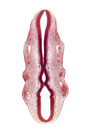 caudal edge of rhombencoel (fourth ventricle), caudal part of rhombencephalon, cephalic part of rhombencephalon, dermatomyotome 2 (O-2) , epipharyngeal placode 2, floor plate of rhombencephalon, junction of precardinal and primary head veins, marginal layer, primary head vein, primordium of facial nerve (CN VII), primordium of trigeminal nerve (CN V), primordium of vagus nerve (CN X), rhombencoel (fourth ventricle), rhombomere 1, rhombomere 2, roof plate of rhombencephalon, sulcus limitans, venous plexus(es), ventral part of rhombomere 4