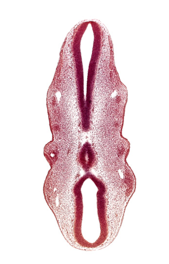 caudal part of rhombencephalon, epipharyngeal placode 2, precardinal vein, primary head vein, rhombencoel (fourth ventricle), rhombomere 1, rhombomere 2