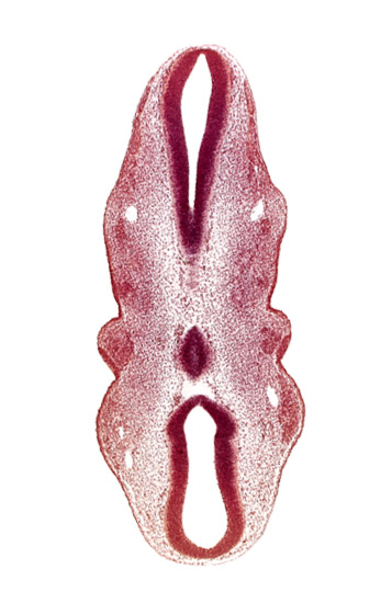 caudal part of rhombencephalon, cephalic part of rhombencephalon, precardinal vein, primary head vein, rhombencoel (fourth ventricle)