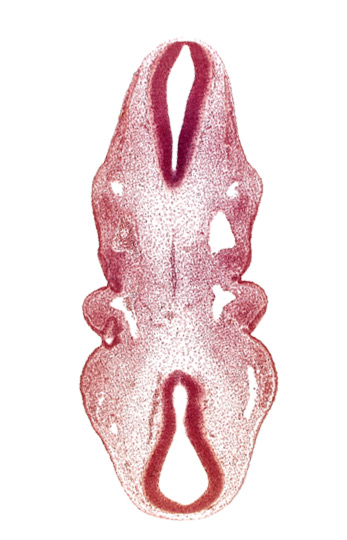 dermatomyotome 2 (O-2) , dermatomyotome 3 (O-3) , dorsal aorta, epipharyngeal placode 2, epipharyngeal placode 3, junction of aortic arch 2 and dorsal aorta, notochord, pharyngeal arch 1, pharyngeal arch 2, pharyngeal groove 1, pharyngeal groove 2, pharyngeal pouch 1, pharyngeal pouch 2, precardinal vein, sclerotome