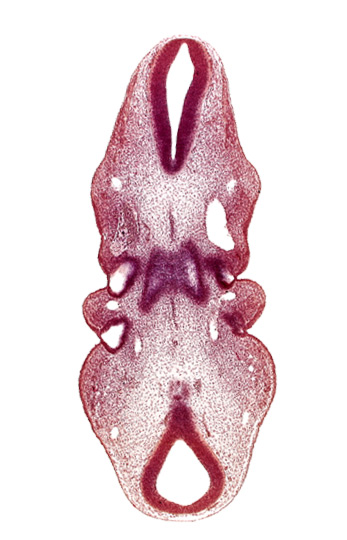 internal carotid artery, junction of mesencephalon and rhombencephalon, notochord, primordium of hypoglossal nerve (CN XII), roof of pharynx primordium